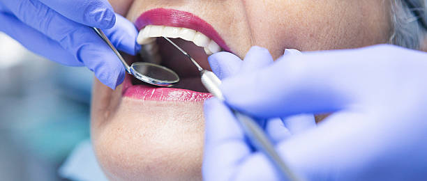 Best Emergency Dental Care for Broken or Chipped Teeth in Overton, TX